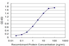 IL13RA2 / IL13R Alpha 2 Antibody (clone 2E10)
