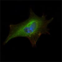 FMR1 / FMRP Antibody (clone 4G9)