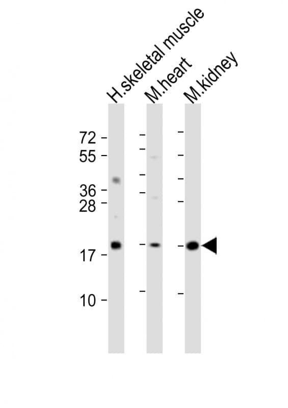 Polyclonal Rabbit anti-Human SDHC Antibody (aa113-144, WB)