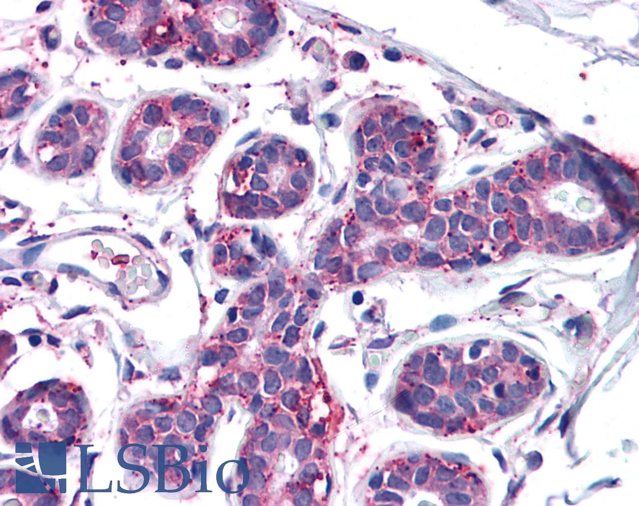 IHC-plus™ MFI2 / p97 Antibody (N-Terminus)