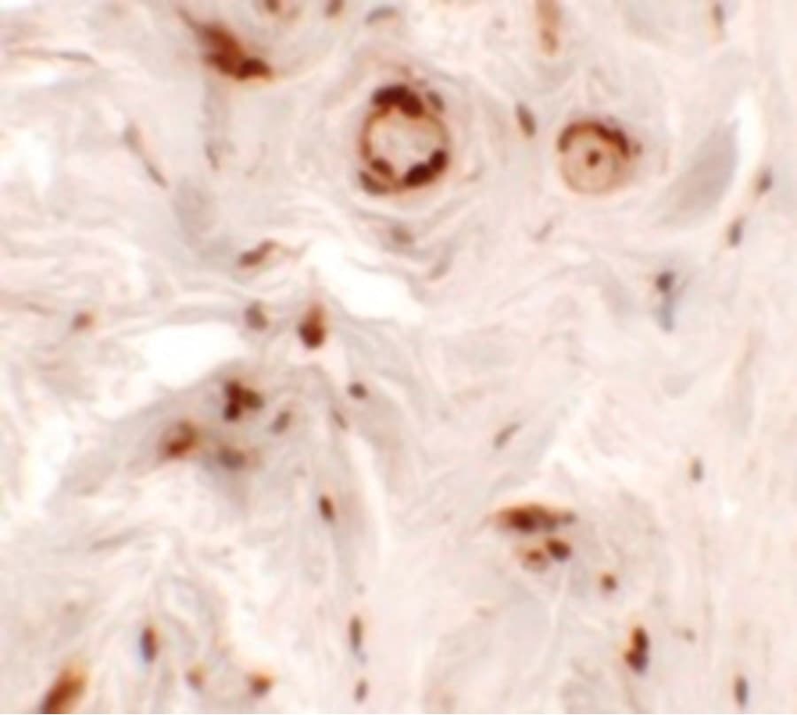 TSPAN20 / UPK1B Antibody