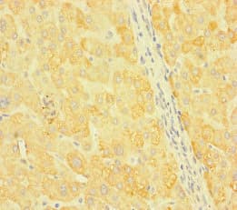 Polyclonal Rabbit anti-Human SNX14 Antibody (IHC, IF)