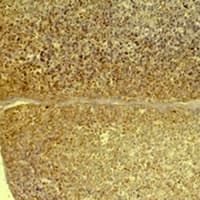 GLP1R / GLP-1 Receptor Antibody