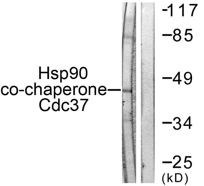 CDC37 Antibody (p13)