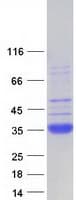 Human SFTPA2 / Surfactant Protein A2 (Recombinant Myc-DDK (Flag))