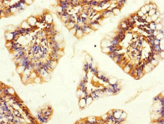 Polyclonal Rabbit anti-Human SNX18 Antibody (IHC, WB)