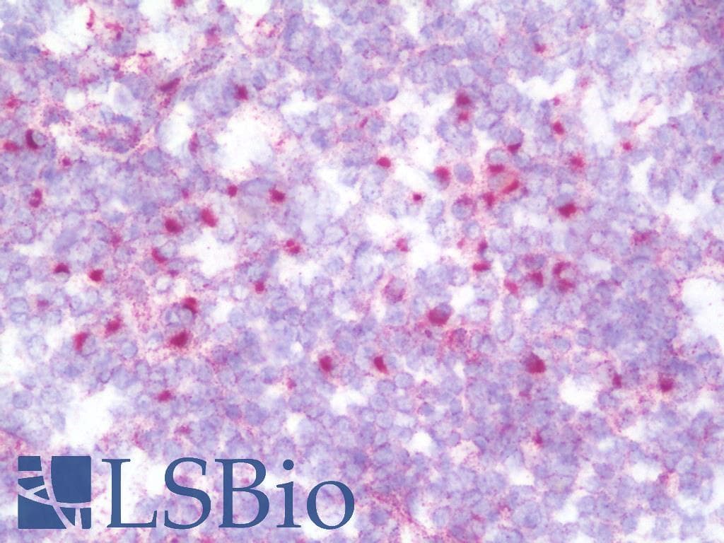 IHC-plus™ Monoclonal Mouse anti-Human GCP60 / ACBD3 Antibody (clone 2G2, IHC, IF, WB)