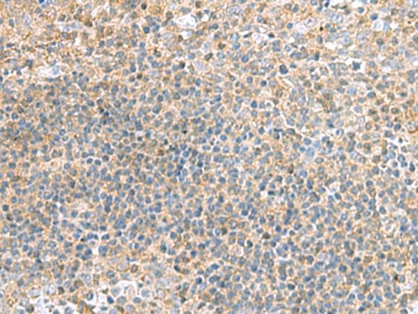 Polyclonal Rabbit anti-Human TSTA3 / GDP-L-Fucose Synthase Antibody (IHC)