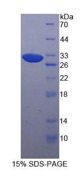 Human PAK4 Protein (Recombinant His-T7)