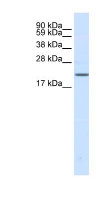 SCN3B Antibody (aa65-114)