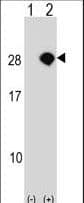 Polyclonal Rabbit anti-Human AKIRIN2 Antibody (aa177-203, WB)