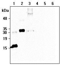 Monoclonal Mouse anti-Human C1QTNF6 / CTRP6 Antibody (clone 256-E, Globular domain, IHC, WB)