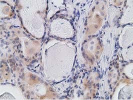 RBBP9 Antibody (clone OTI4G9)