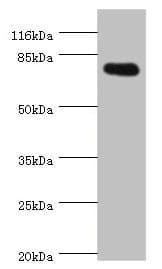SH2B1 Antibody