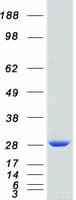 Human RAB11A Protein (Recombinant Myc-DDK (Flag))