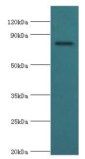 Polyclonal Rabbit anti-Human COMP / THBS5 Antibody (aa20-160, WB)