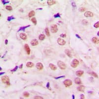 Polyclonal Rabbit anti-Human TRPS1 Antibody (N-Terminus, IHC, WB)