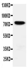 Polyclonal Rabbit anti-Human HIF3A / HIF3-Alpha Antibody (aa497-514, WB)