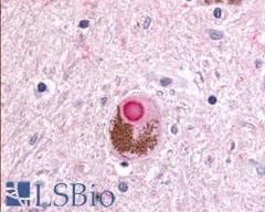 PathPlus™ Polyclonal Rabbit anti-Human DUSP22 / JSP 1 Antibody (Internal, IHC)