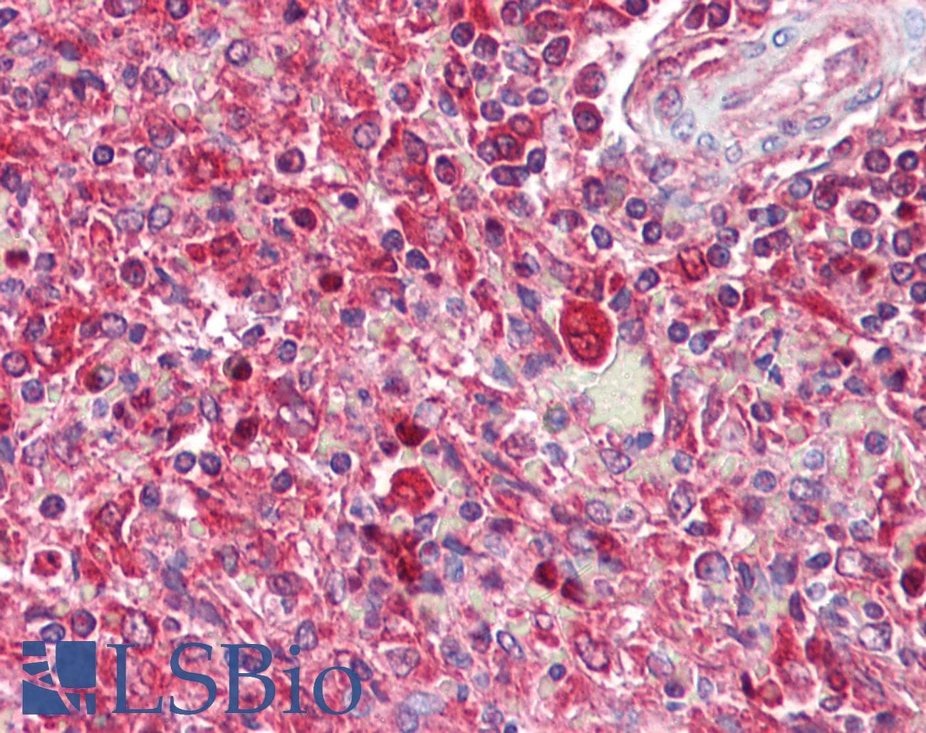IHC-plus™ SNX2 Antibody (aa350-400)