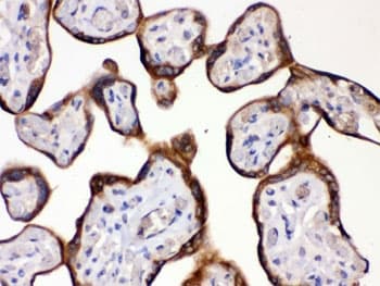 HSD2 / HSD11B2 Antibody