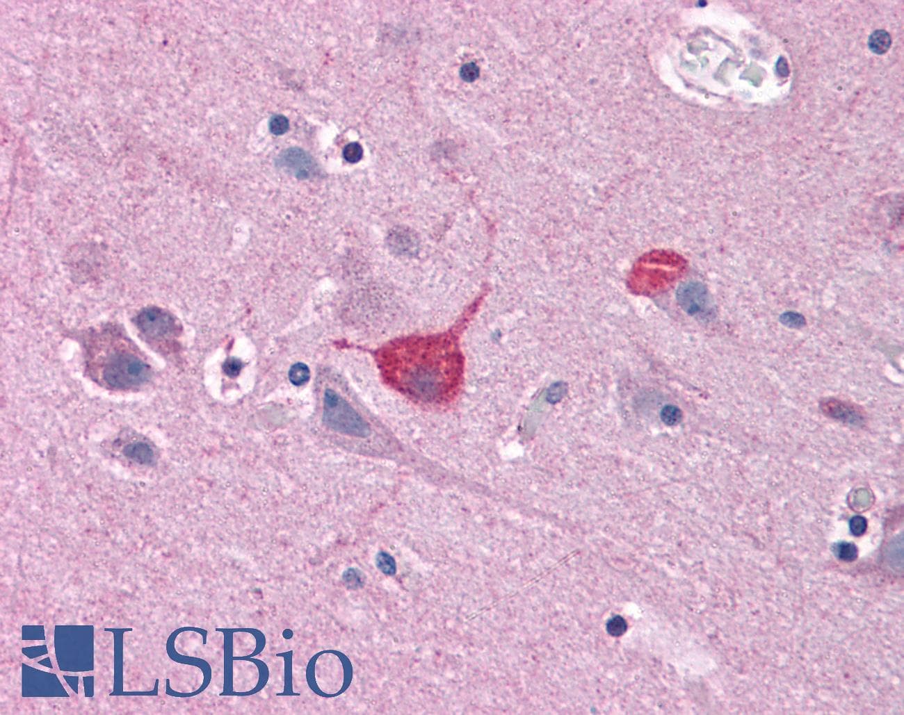 IHC-plus™ BOK Antibody