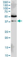 Monoclonal Mouse anti-Human SIAH1 Antibody (clone 2C5, WB)