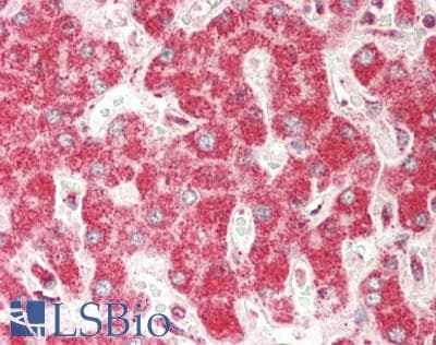 IHC-plus™ Polyclonal Rabbit anti-Human TRIM3 Antibody (aa1-50, IHC)