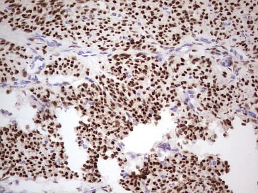 PR / Progesterone Receptor Antibody (aa1-298, clone OTI24D6)