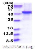 Human GNAQ Protein (Recombinant His)