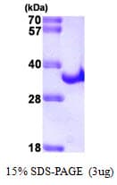 Hepatitis C Virus HCV NS3 Protein (Recombinant His)