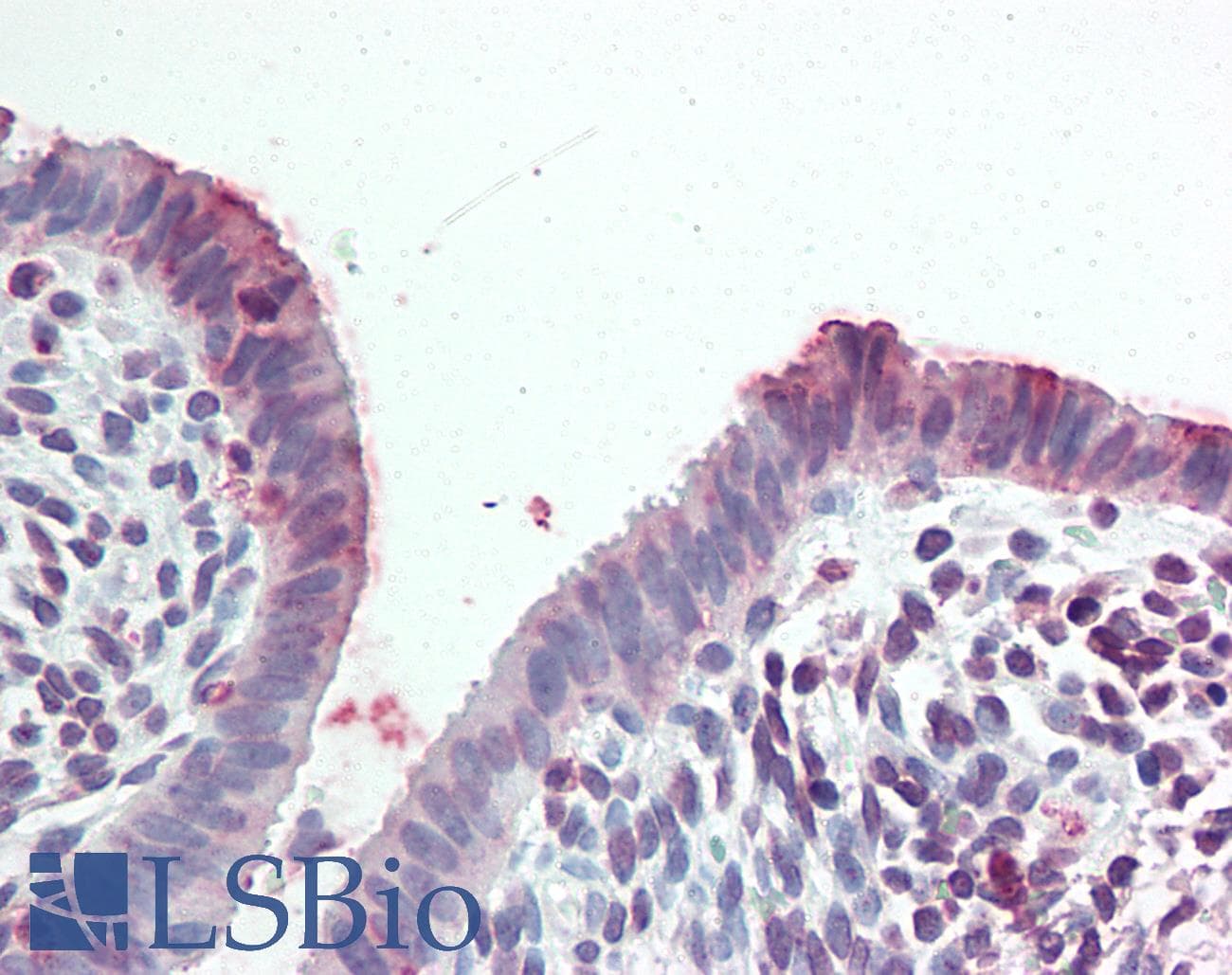 IHC-plus™ STEAP2 Antibody (C-Terminus)
