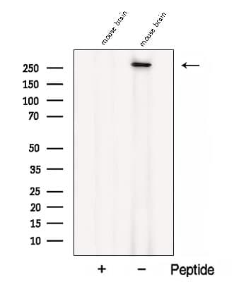 Polyclonal Rabbit anti-Human CACNA1B / Cav2.2 Antibody (WB)