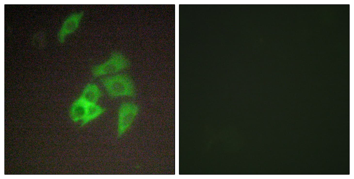 IHC-plus™ Polyclonal Rabbit anti-Human ST14 / Matriptase Antibody (aa10-59, IHC, IF, WB)