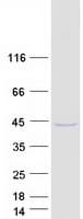 Human TMUB2 Protein (Recombinant Myc-DDK (Flag))