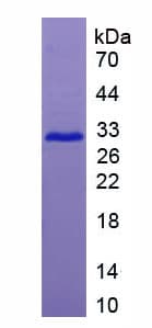 Human NOX1 Protein (Recombinant His)
