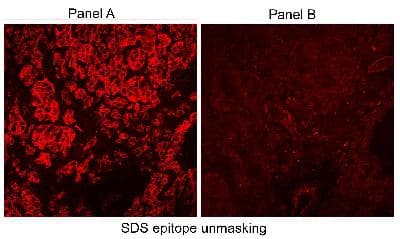 CA9 / Carbonic Anhydrase IX Antibody (C-Terminus, DY488)
