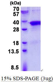 Human TSNAX / TRAX Protein (Recombinant His)