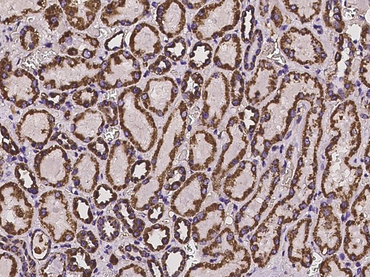 HIBADH Antibody