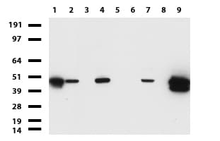 Monoclonal Mouse anti-Human KRT19 / CK19 / Cytokeratin 19 Antibody (clone UMAB188, aa240-390, IHC, IF, WB)