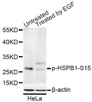 HSPB1 / HSP27 Antibody (phospho-Ser15)
