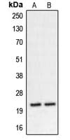 IHC-plus™ CHP2 Antibody (Internal)