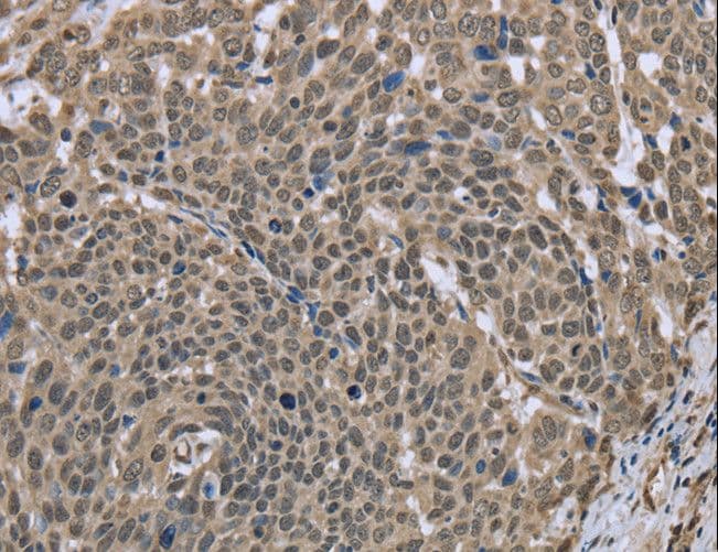 Polyclonal Rabbit anti-Human DCTN4 / Dynactin 4 Antibody (IHC)