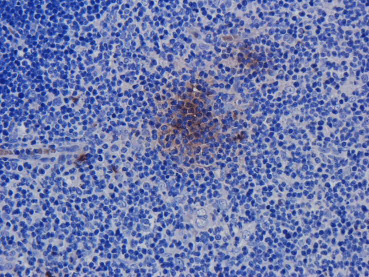 CD52 Antibody (CD52, clone Campath-1H)