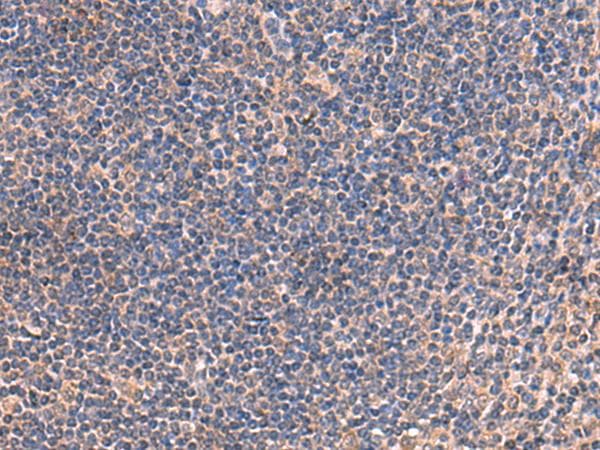 IP6K2 Antibody