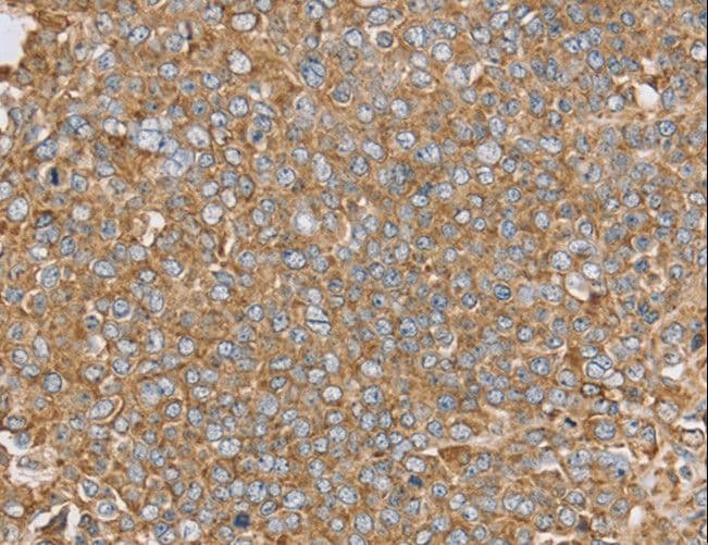 IHC-plus™ Polyclonal Rabbit anti-Human PTGER2 / EP2 Antibody (IHC, WB)