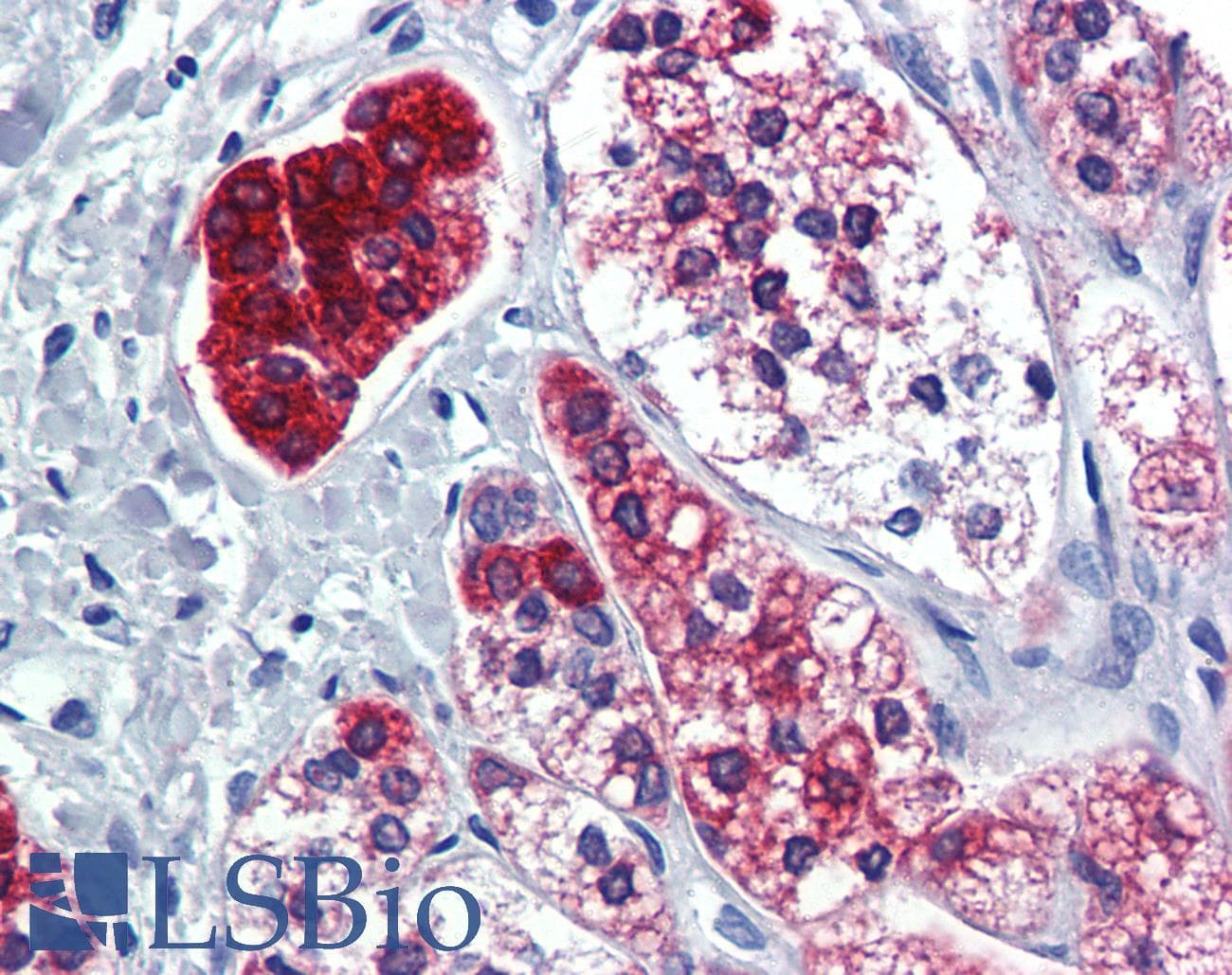 IHC-plus™ PPARG / PPAR Gamma Antibody (aa170-270, clone 3A4A9)