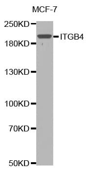 Polyclonal Rabbit anti-Human ITGB4 / Integrin Beta 4 Antibody (WB)