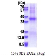 Human TSSK6 Protein (Recombinant His)