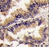 Polyclonal Rabbit anti-Human MAPK1 / ERK2 Antibody (aa154-183, IHC, WB)